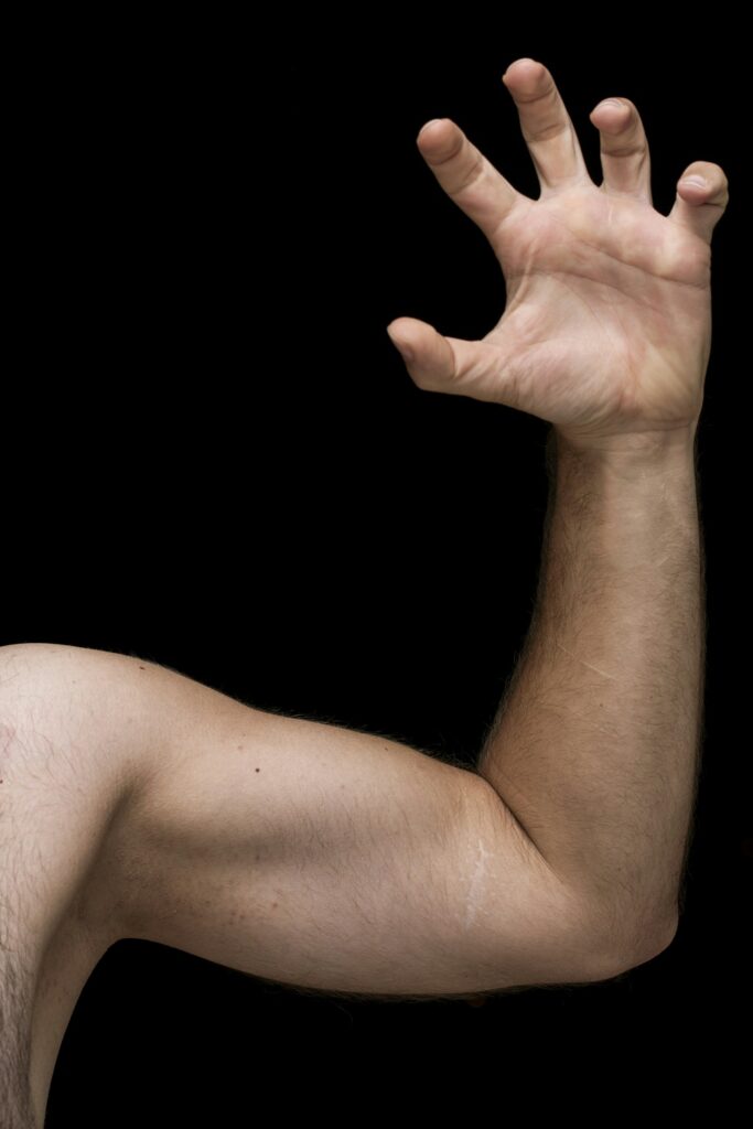 ongle qui pousse vers le haut