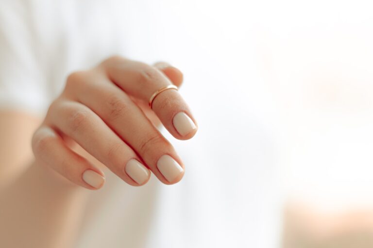 Main avec une matrice d'ongle détruite en cours de repousse après traumatisme